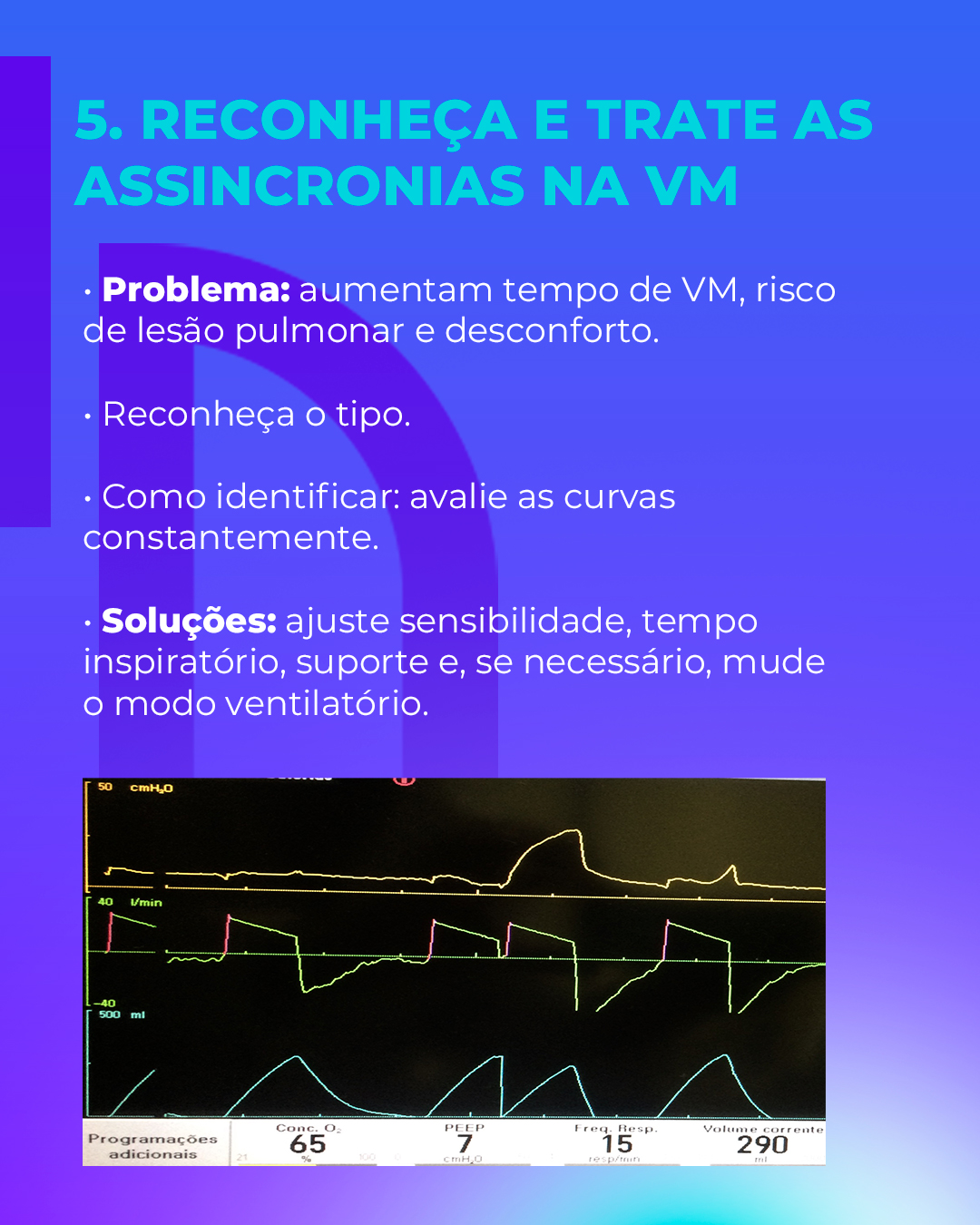 7 Pneumoclinicagens na UTI