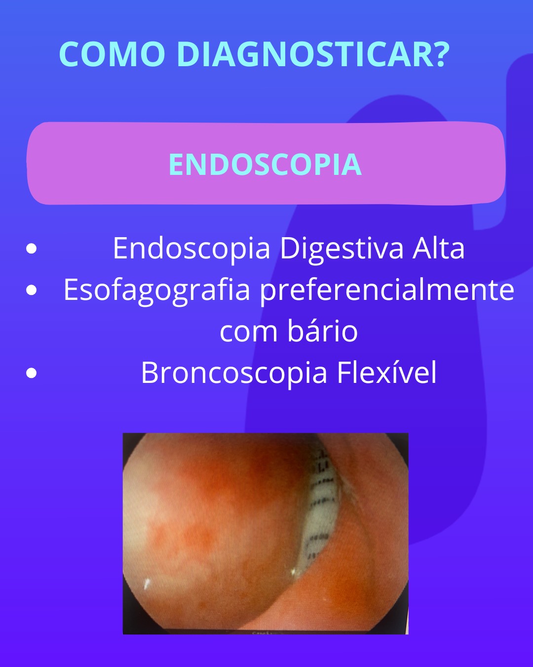 Guia rápido de identificação de fístula traqueoesofágica