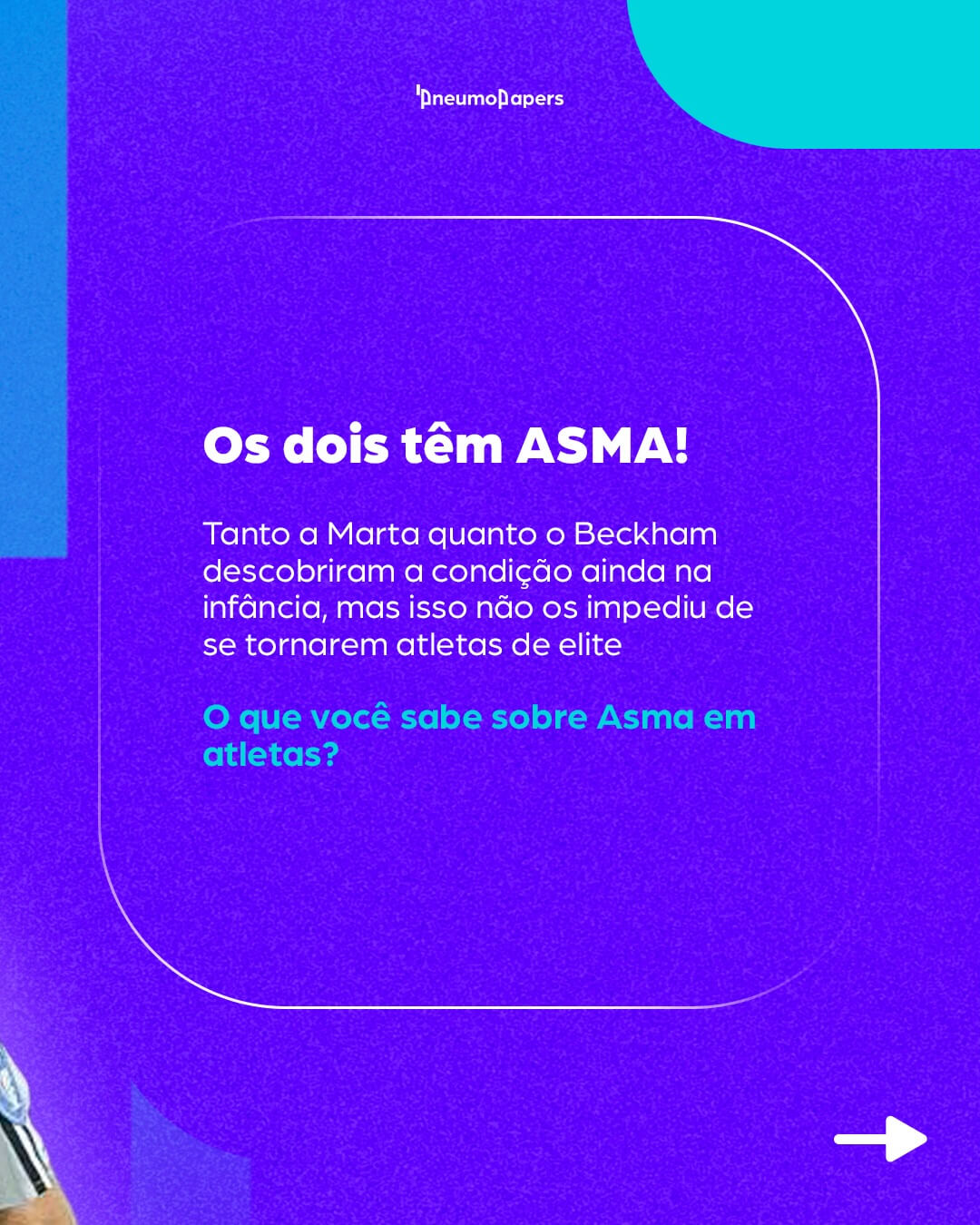 O que a Marta e o Beckhman tem a ver com a Pneumologia?
