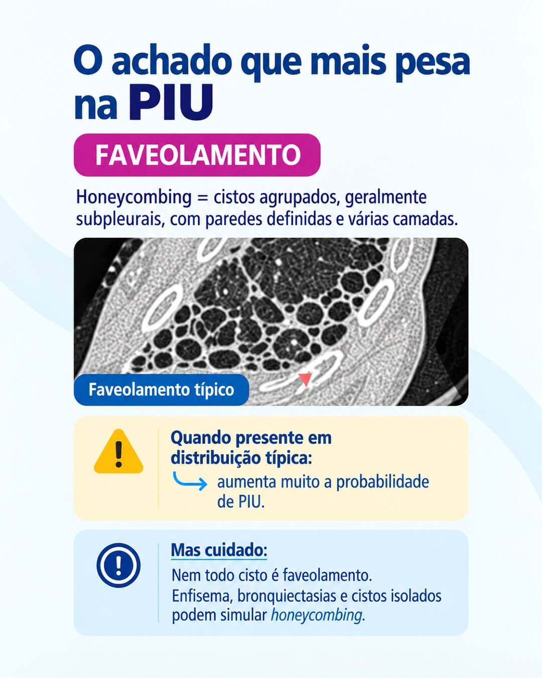 Como diferenciar os padrões na TC de tórax?