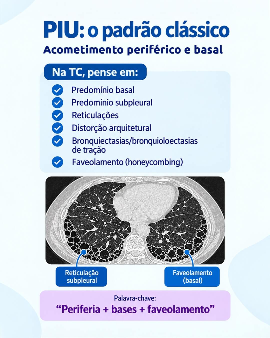 Como diferenciar os padrões na TC de tórax?