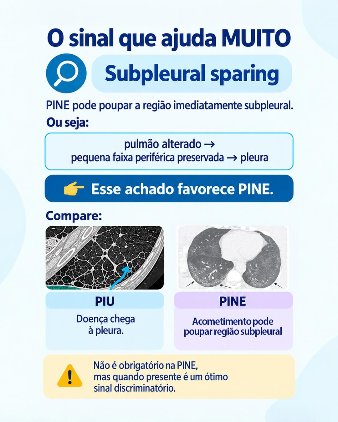 Como diferenciar os padrões na TC de tórax?